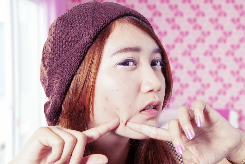 lấy nhân mụn có hết mụn không. Nữ sinh thiếu niên nặn mụn trong phòng ngủ