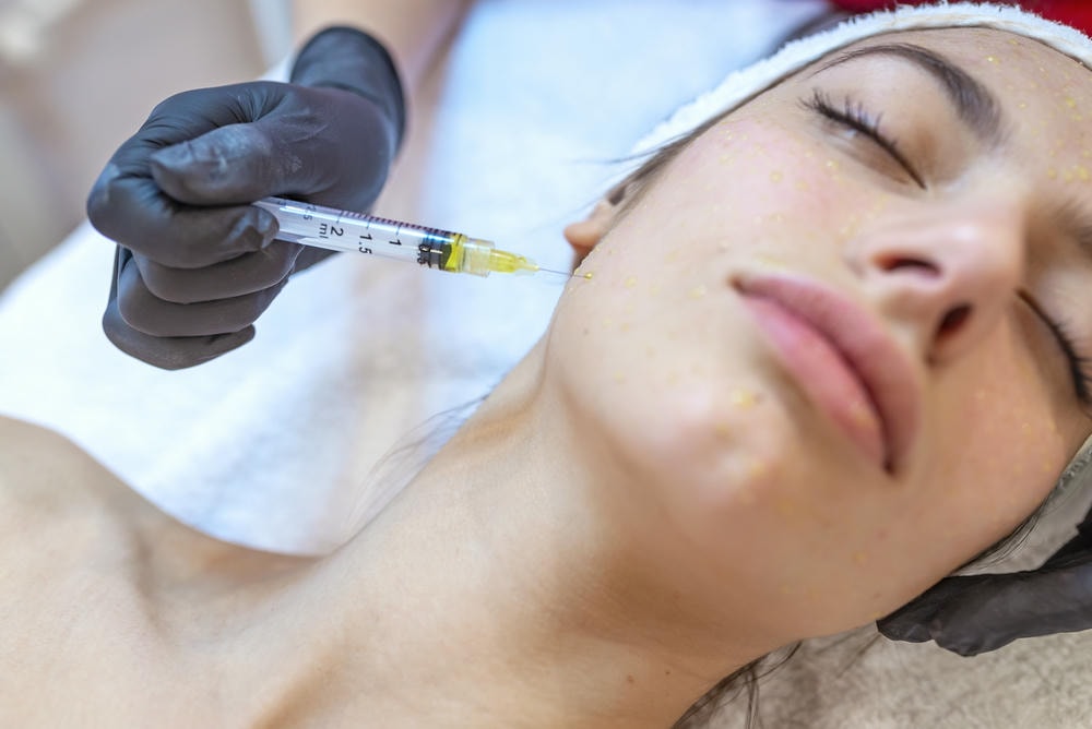 meso. Liệu pháp Meso trên trán. Điều trị bằng Mesotherapy. Thủ thuật mesotherapy. Bác sĩ thẩm mỹ thực hiện thủ thuật mesotherapy trên đầu người phụ nữ. Tăng cường sức mạnh cho tóc và sự phát triển của chúng.