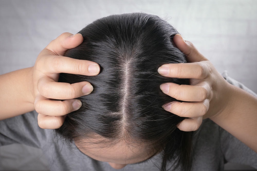 mọc tóc. Phụ nữ trẻ Châu Á lo lắng về các vấn đề như rụng tóc, hói đầu, gàu.
