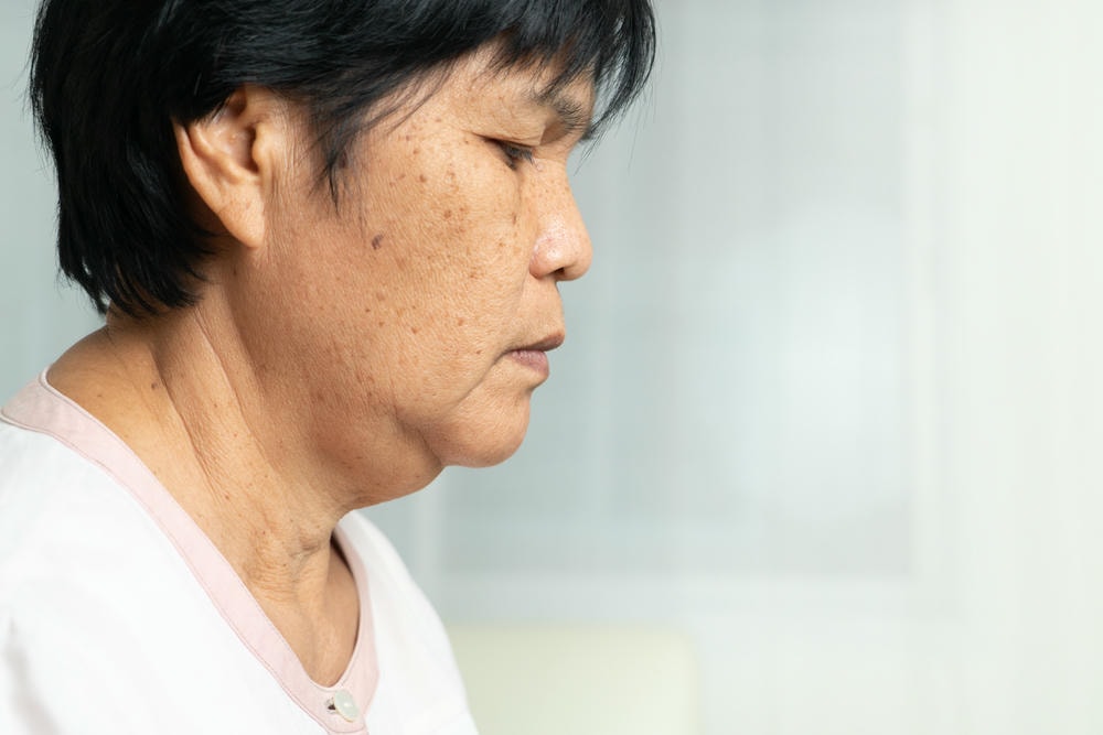 Hãy nhận biết rằng nguyên nhân nám mảng thường được gắn liền với các yếu tố nội tiết, theo đánh giá của chuyên gia da liễu Lona, và điều trị nám mảng bằng liệu pháp hiện đại sẽ giúp phòng ngừa nám mảng hiệu quả.