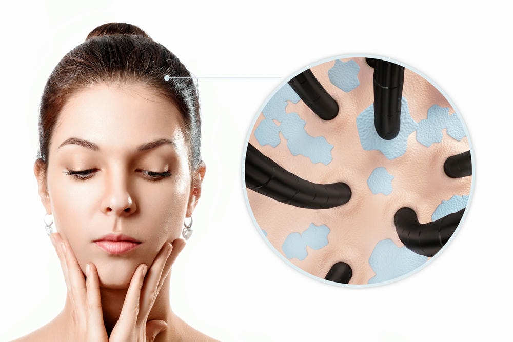 peel da sinh học là gì. Bệnh nấm da gàu trên da đầu Hình ảnh phóng to của tóc và da đầu Vi trùng và mụn nước hoặc mụn nhọt trên đầu