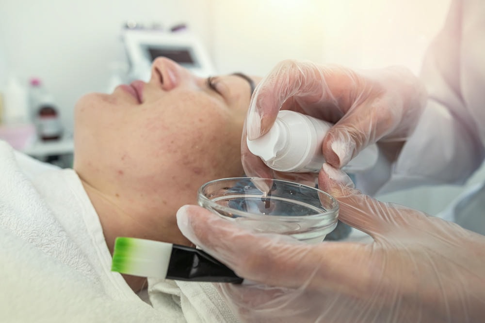 Ảnh thể hiện qui trình peel da trong chemical peel là gì, khi chuyên gia da liễu tại Lona Skin Lab tiến hành Chemical Peel và thay da sinh học để đem lại làn da trẻ trung.
