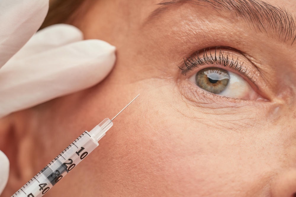 profhilo. Bàn tay của chuyên gia thẩm mỹ đeo găng tay bảo vệ cầm ống tiêm gần mắt phụ nữ