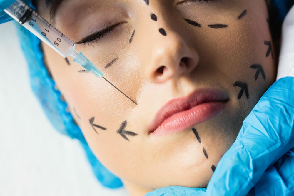 restylane. Người phụ nữ được tiêm vào môi