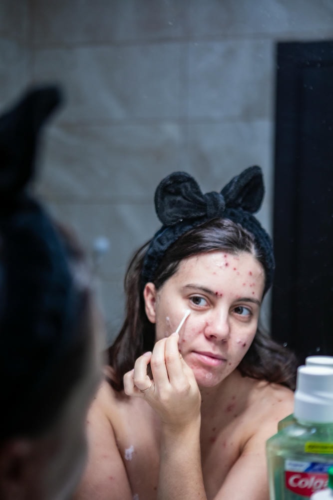 Ảnh chụp sản phẩm retinol trị mụn của Lona Skin Lab được chuyên gia da liễu khuyến nghị về cách sử dụng retinol để đảm bảo hiệu quả retinol trị mụn vượt trội.