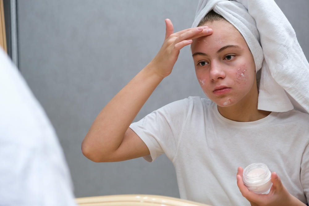 Hình ảnh minh họa retinol trị mụn cho thấy chuyên gia da liễu tại Lona Skin Lab đang hướng dẫn cách sử dụng retinol nhằm đạt hiệu quả retinol trị mụn tối ưu.