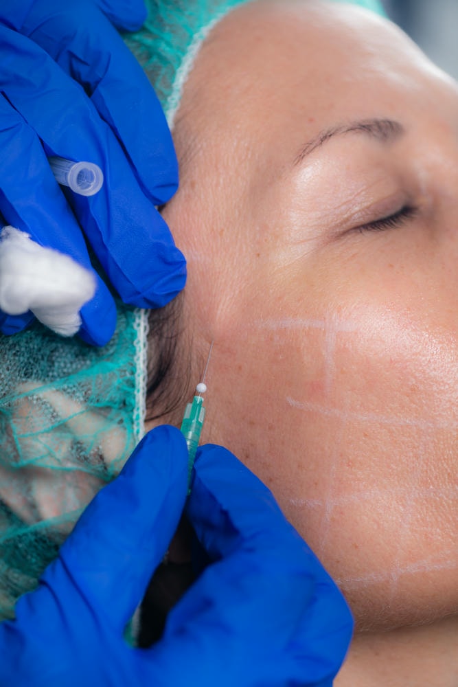 teoxane. Ảnh cận cảnh người phụ nữ trong quá trình tiêm botox