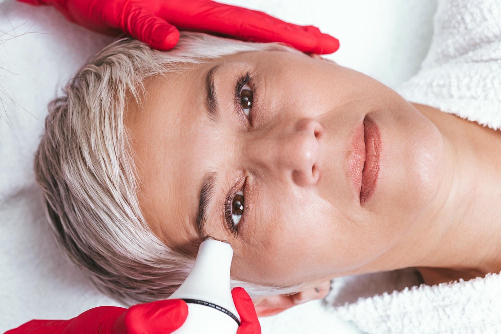 Hình ảnh minh họa Thermage là gì và công nghệ trẻ hóa da hiện đại, nơi sóng RF được ứng dụng hiệu quả nhằm trẻ hóa da không xâm lấn và nâng cơ mặt tự nhiên.