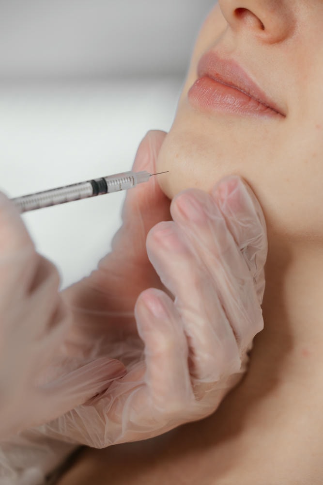 Những chuyên gia Lona Skin Lab truyền đạt bí quyết làm đẹp cằm qua quy trình tiêm filler cằm tròn, kết hợp kỹ thuật tiêm filler hiện đại và khả năng tạo dáng cằm tự nhiên, giúp khách hàng đạt được tiêu chuẩn cằm tròn và khẳng định bí quyết làm đẹp cằm qua từng bước điều trị.