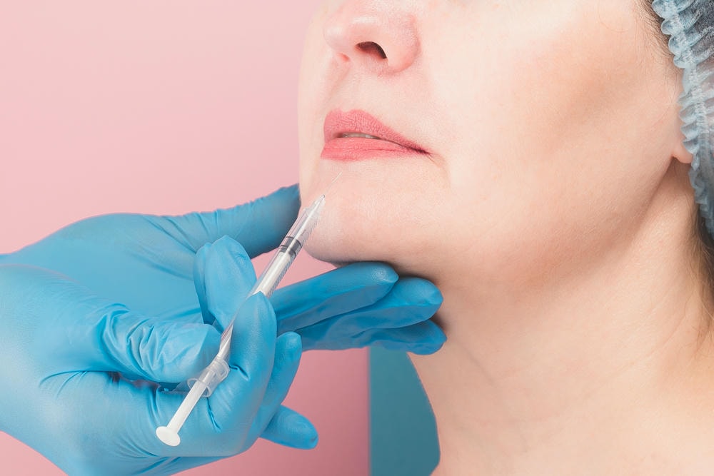 tiêm filler cằm. Người phụ nữ trung niên xinh đẹp được tiêm thẩm mỹ lên môi, cận cảnh.