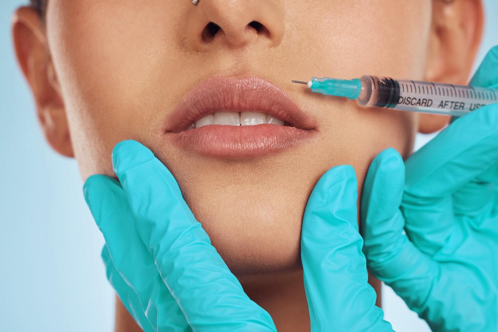 Bức ảnh thể hiện kỹ thuật tiêm filler môi trái tim tinh vi, khi chuyên gia da liễu thẩm mỹ cẩn thận phân tích tiêm filler môi và áp dụng phương pháp tạo hình môi trái tim nhằm đạt được môi trái tim tự nhiên và thẩm mỹ môi trái tim quyến rũ.