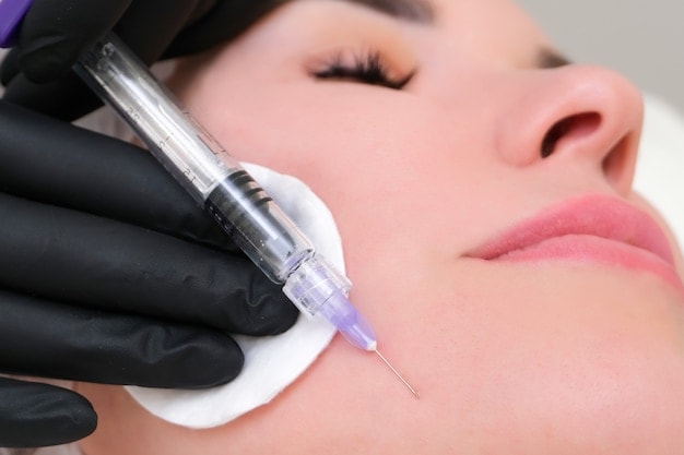 Ảnh chụp chuyên sâu về tiêm botox nọng cằm, đi kèm tiêm nọng cằm và tiêm filler cằm để hoàn thiện đường nét cằm V-line, đảm bảo tiêu chí thẩm mỹ không phẫu thuật an toàn.