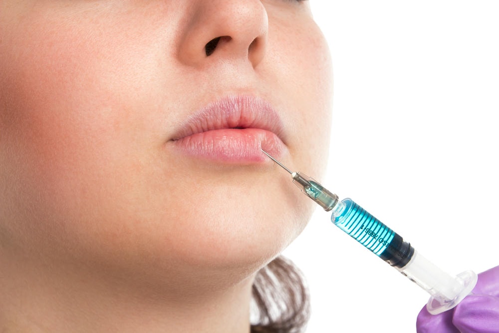 Trên hình ảnh này, bác sĩ thực hiện tiêm filler môi tây bằng phương pháp tiêm filler môi tây an toàn, giúp tạo dáng môi tây sắc sảo với filler môi tây chất lượng, qua đó làm nổi bật ưu điểm tiêm filler môi tây một cách tự nhiên và hiệu quả.
