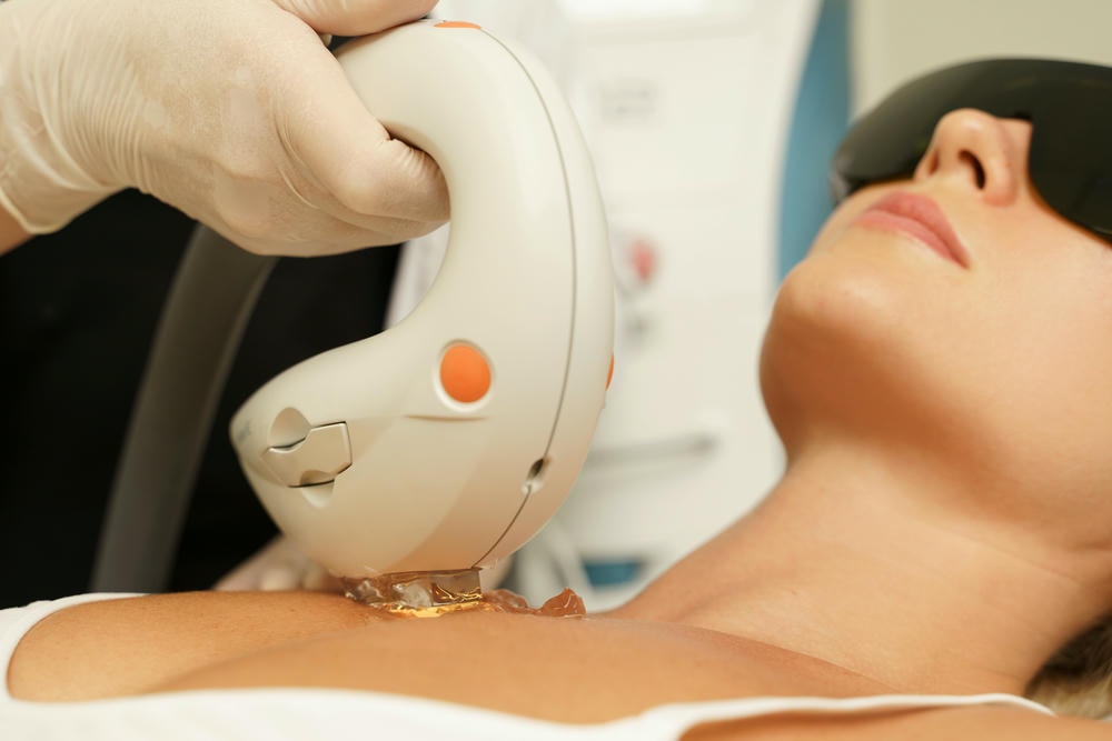 ulthera prime. Khách hàng nữ trong quá trình điều trị IPL tại phòng khám y tế thẩm mỹ