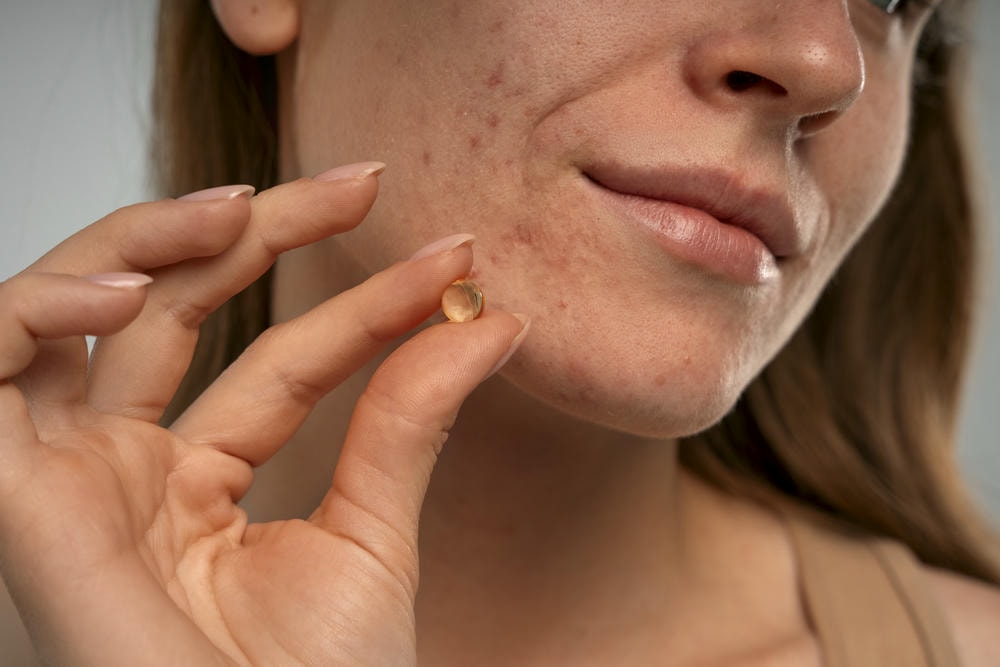 Trong thực hành da liễu, viên uống trị mụn chứa vitamin E trị thâm mụn được khuyên dùng nhờ công dụng vitamin E vượt trội, với cách sử dụng vitamin E đúng liều và lưu ý khi dùng vitamin E để tối ưu hóa hiệu quả điều trị mụn.