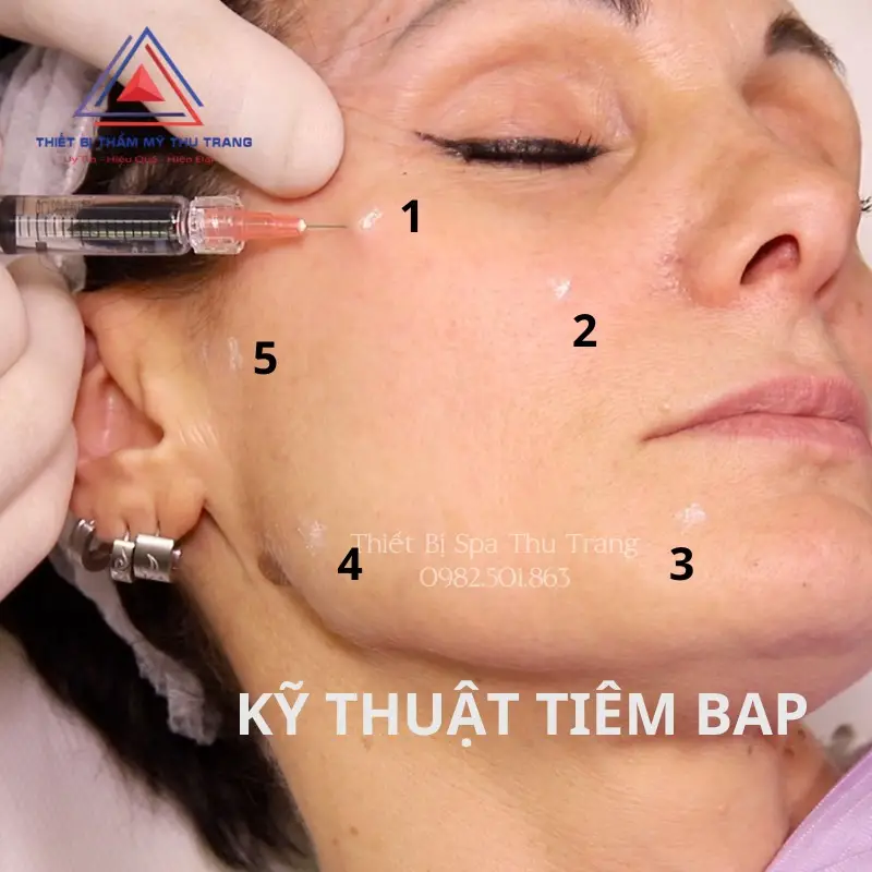 Cơ chế “skin quality” của bap 5 điểm
