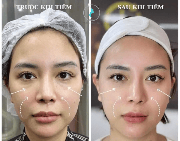 Hiệu quả mong đợi và thời gian duy trì