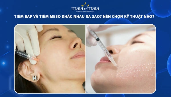 Câu hỏi thường gặp (FAQ)