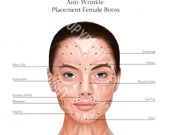 Điểm tiêm beautem botox: Chi tiết theo vùng