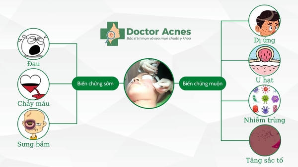 Yếu tố làm tăng nguy cơ biến chứng peel và biến chứng mesoestetic