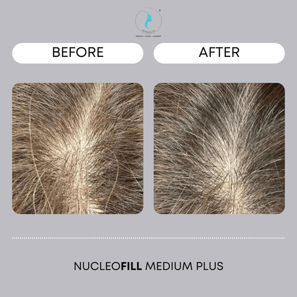 Chi tiết về một số phương pháp xử trí