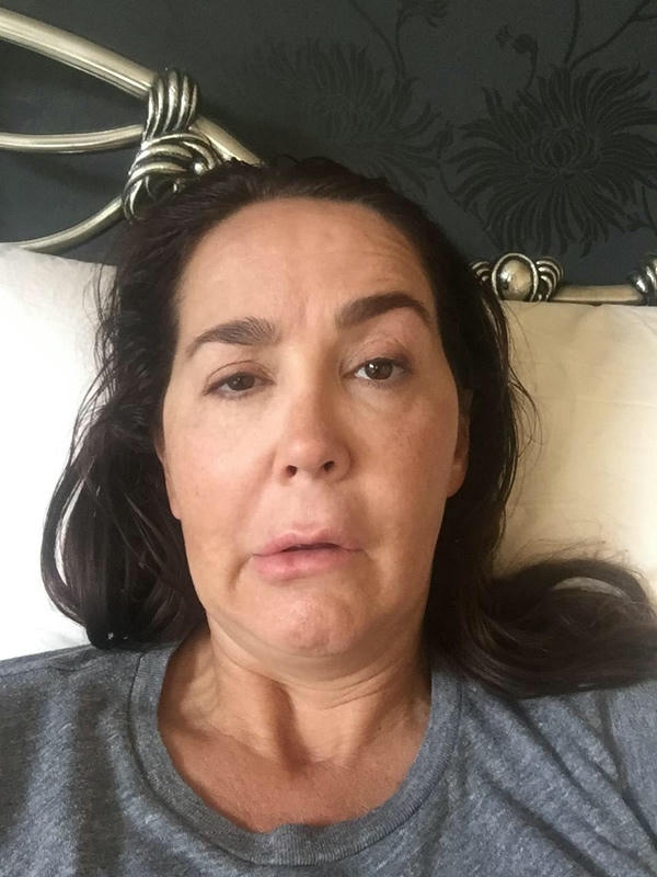 2. Xử trí lệch mặt và bất đối xứng