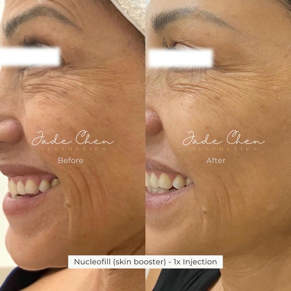 Chiến lược kết hợp: khi nào áp dụng đồng thời