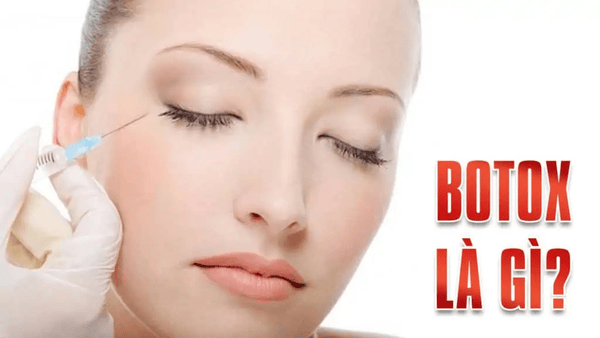 Điểm quan trọng khi tiêm trong botox aesthetics