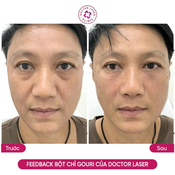 Gouri clinic review: cách đọc và đánh giá phản hồi