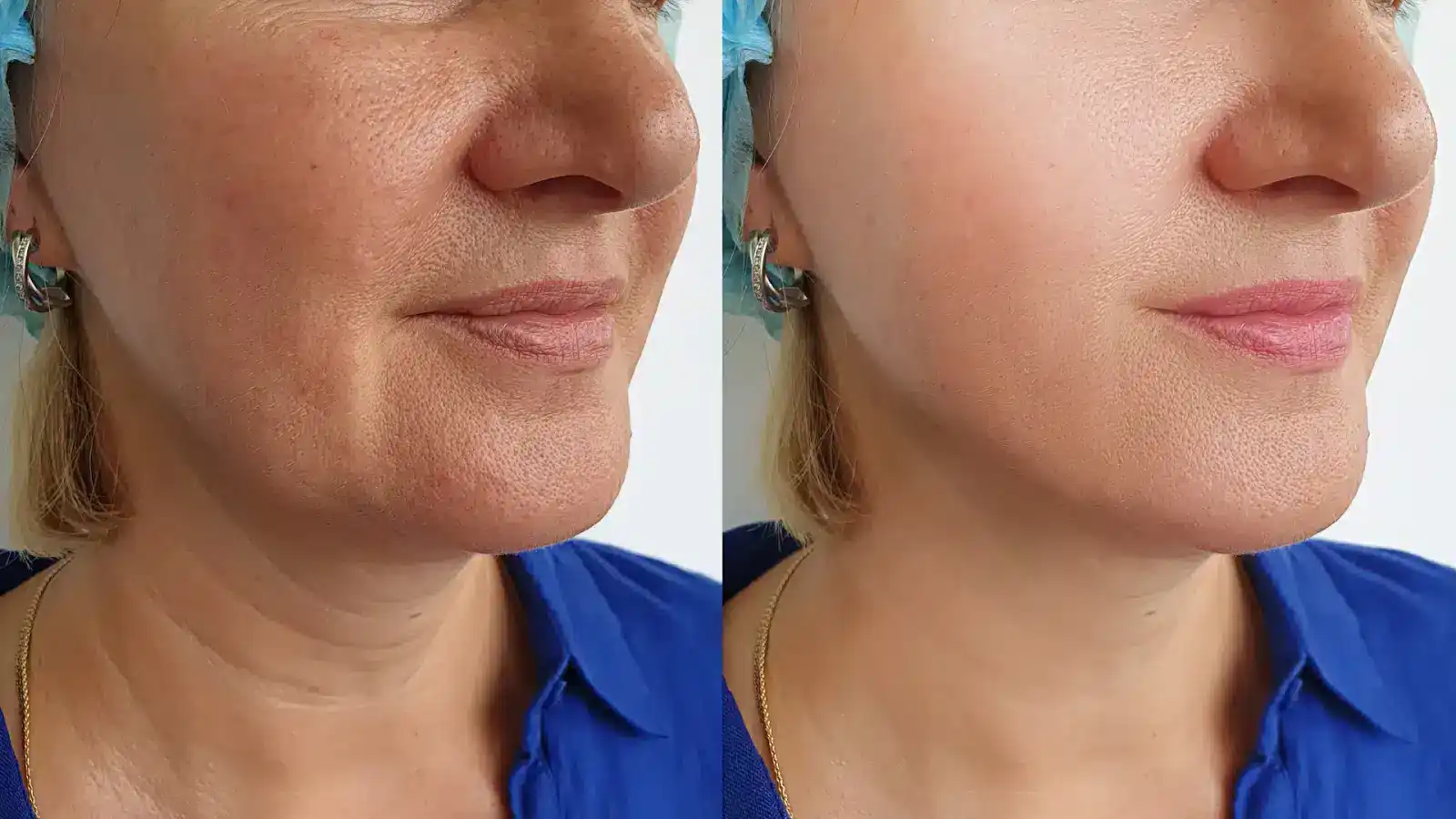 Kỳ vọng thay đổi theo mốc thời gian