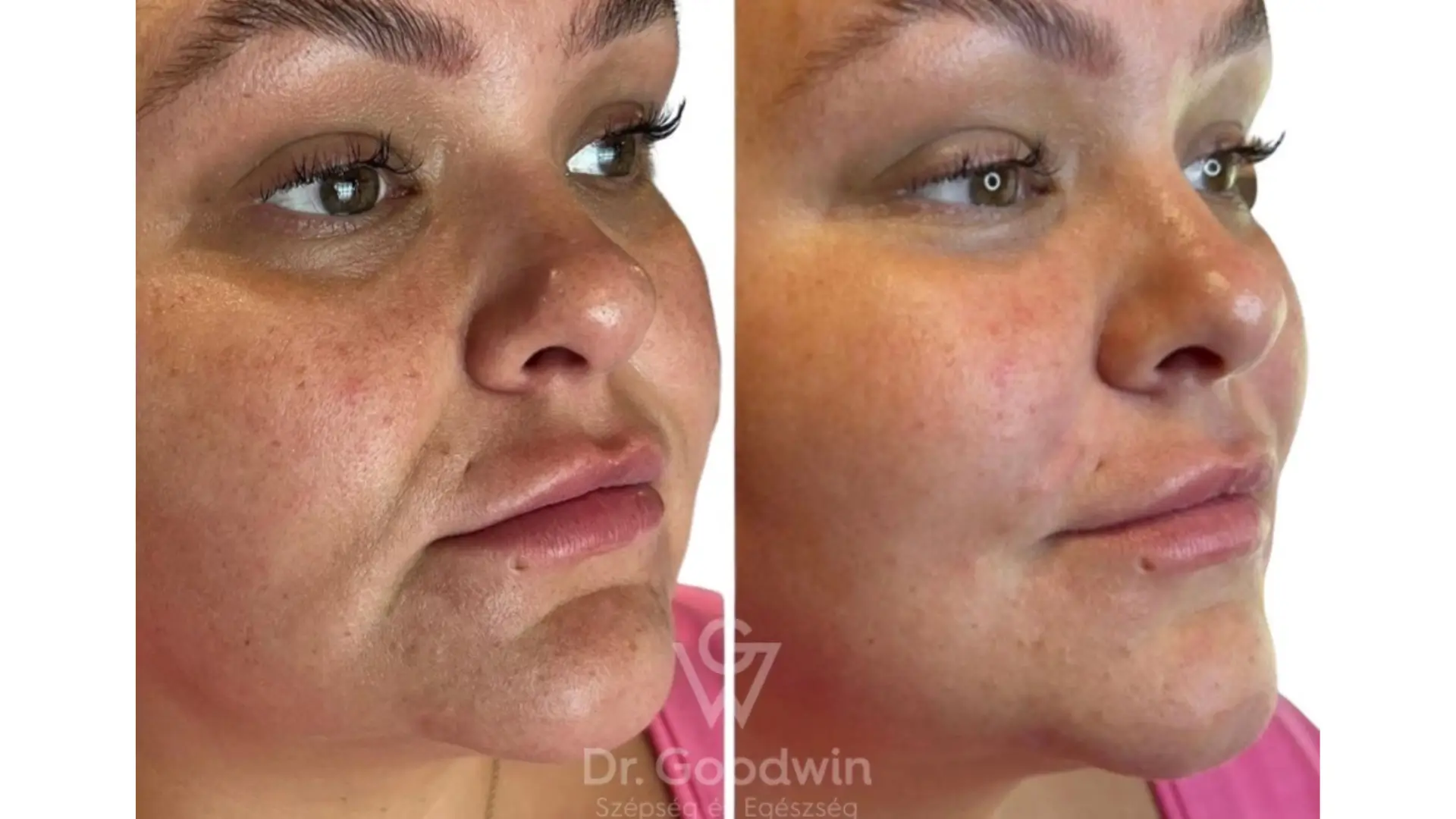 Ai phù hợp với Jalupro