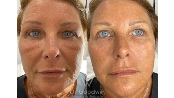 Phân tích chuyên sâu: khi nào chọn ejal40 vs jalupro