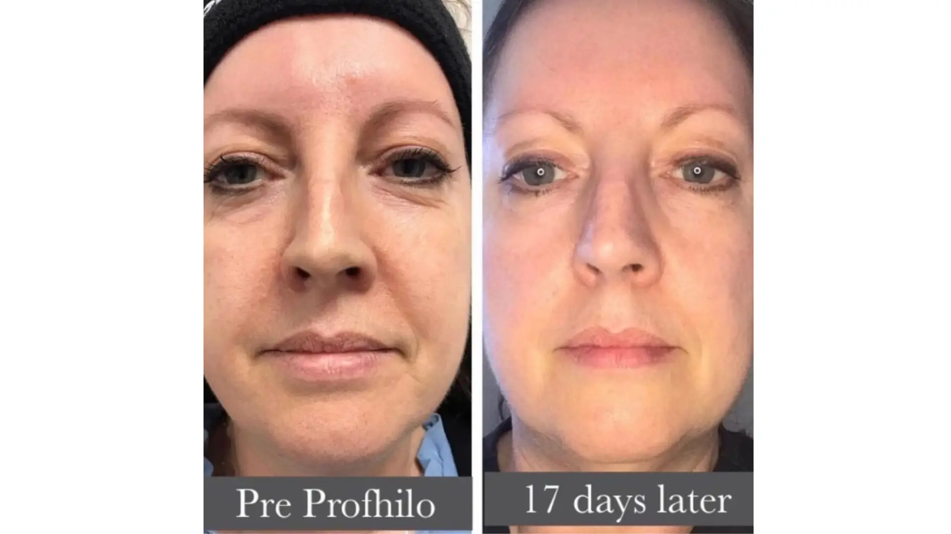 2. Bao lâu thấy hiệu quả khi so sánh ejal40 vs jalupro