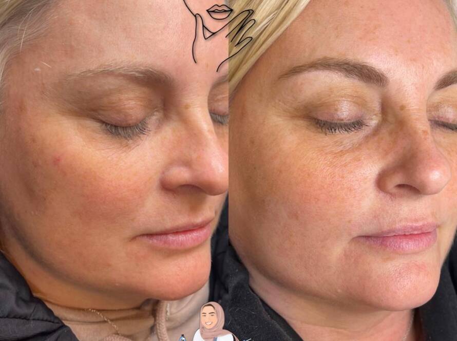 Bảng so sánh nhanh