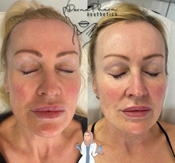 Kết hợp liệu pháp: có nên dùng chung?