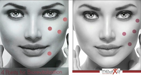 Ejal40 fine lines: cải thiện nếp nhăn mịn quanh mắt