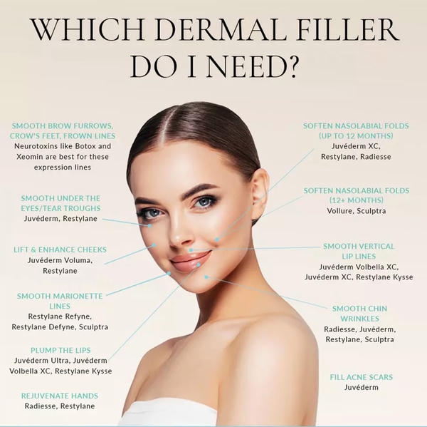 Điểm mạnh chung của filler châu Âu (đại diện: elial)