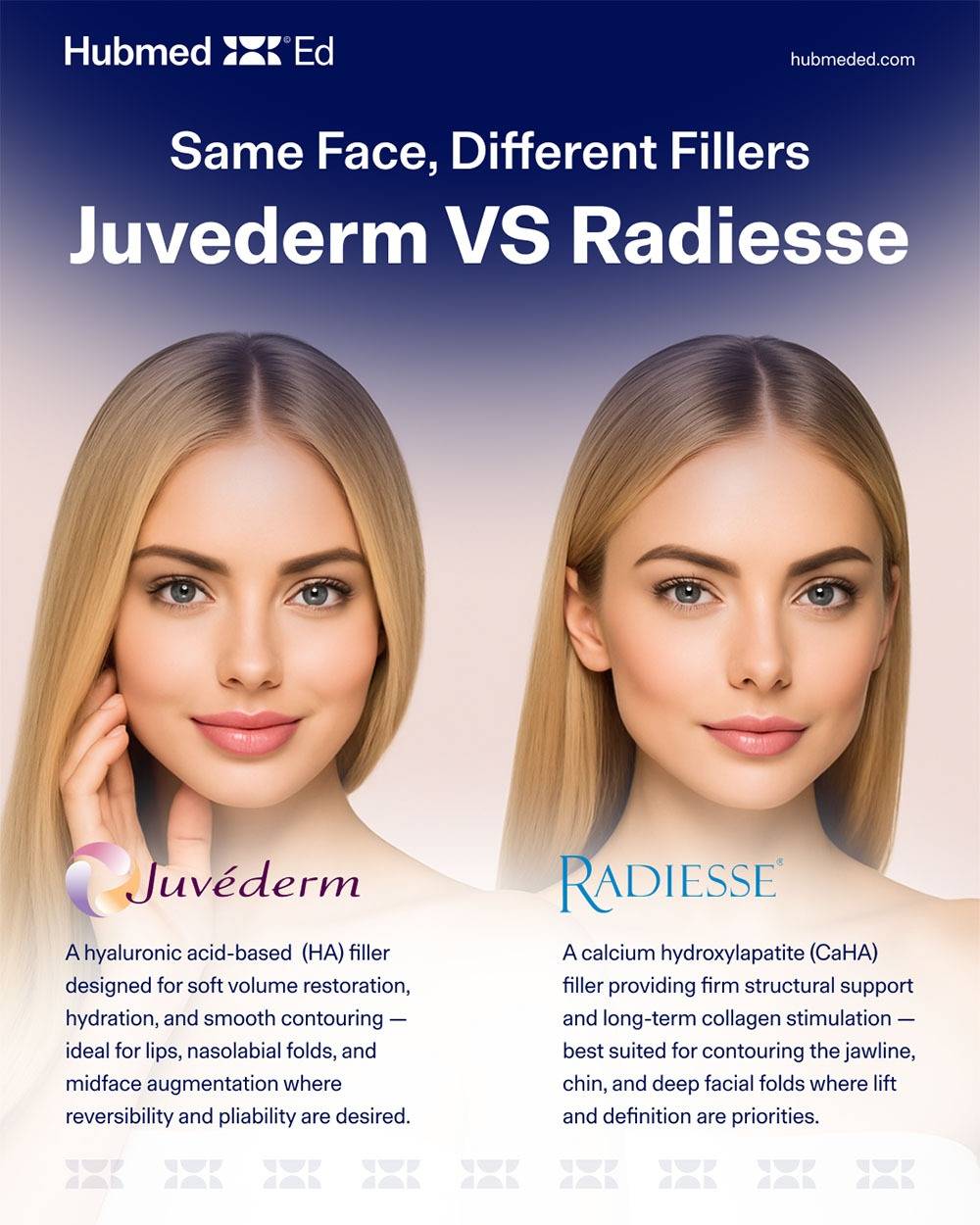 Hướng dẫn chọn lựa cho từng mục tiêu