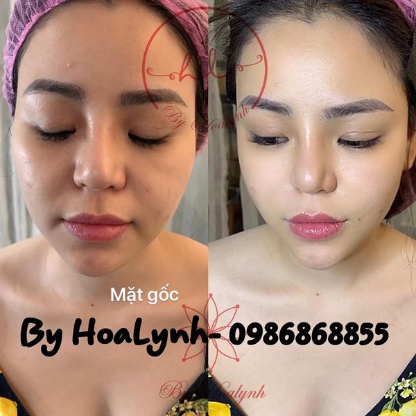 FAQ - Các câu hỏi thường gặp