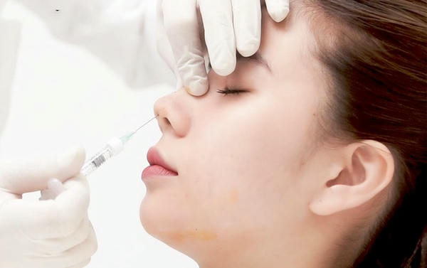 Nâng mũi bằng filler: nguyên tắc nose filler safety