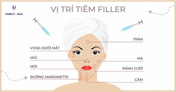 Jawline contouring và lựa chọn filler cho đường hàm