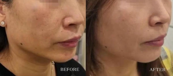 Gợi ý chăm sóc trong gouri 3 tháng