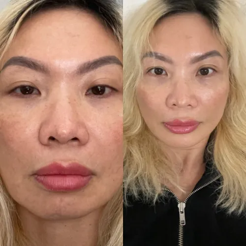 So sánh nhanh: gouri 1 tháng | gouri 3 tháng | gouri 6 tháng