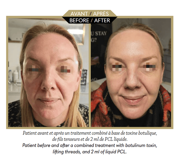 Kết luận: gouri before and after - tổng quan thực tế