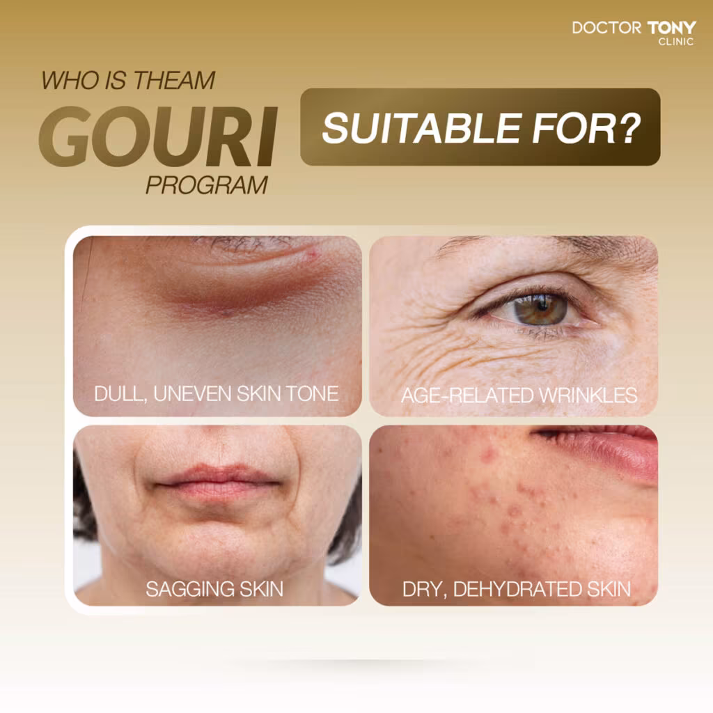 Sau tiêm gouri 3 tháng có cần làm gì đặc biệt