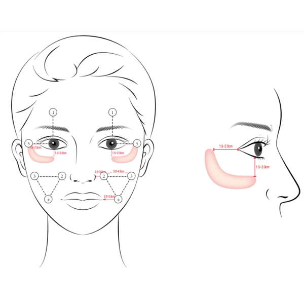 Gouri điểm tiêm: Sơ đồ và mô tả từng vị trí