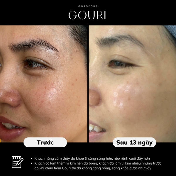 Bao lâu thấy hiệu quả sau một lần điều trị