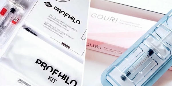 Ưu điểm chính của Profhilo