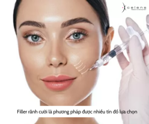 Những lưu ý khi tìm hiểu về filler infini rãnh cười