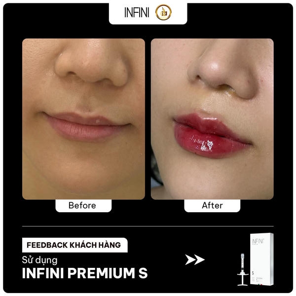 4. Infini có thể hòa tan nếu không ưng ý không